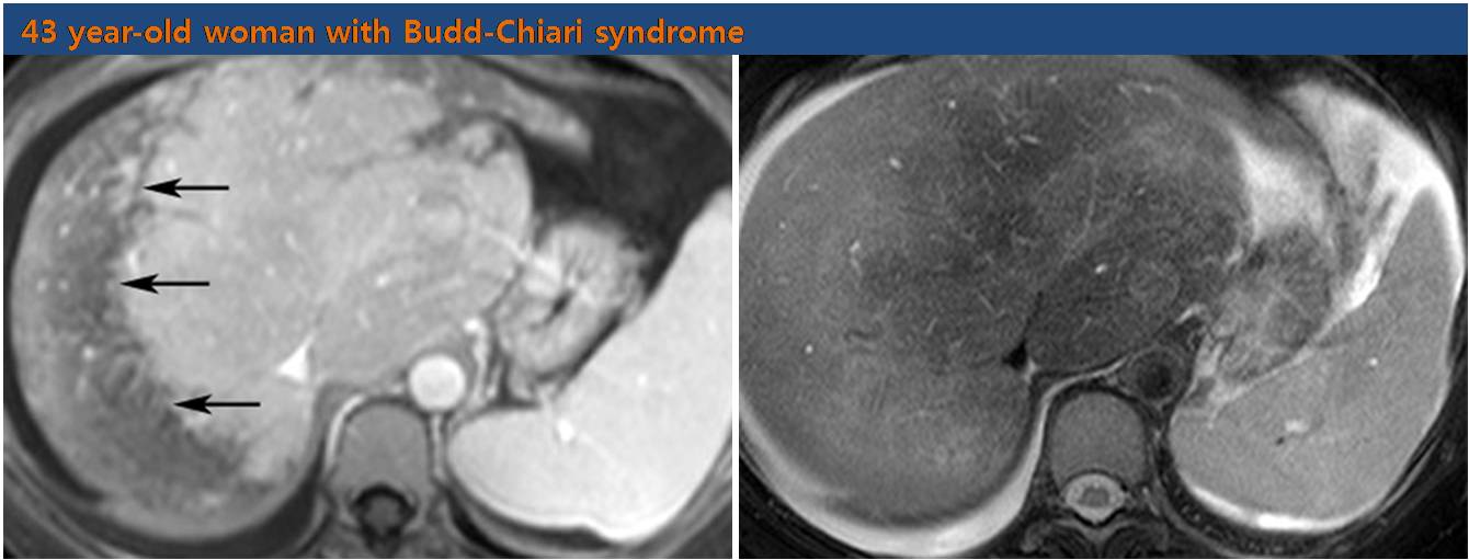 The Korean Society of Abdominal Radiology